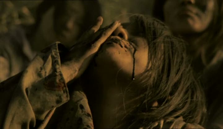 Hiroshima: Harrowing Aftermath Of Atomic&nbsp;Bomb